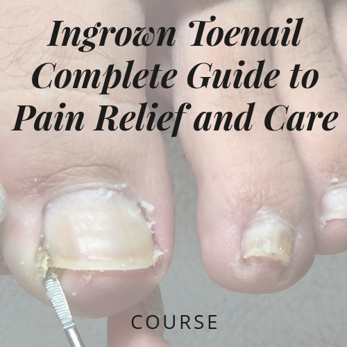 Conquer Ingrown Toenail Pain: Your Complete Guide to Relief and Care
