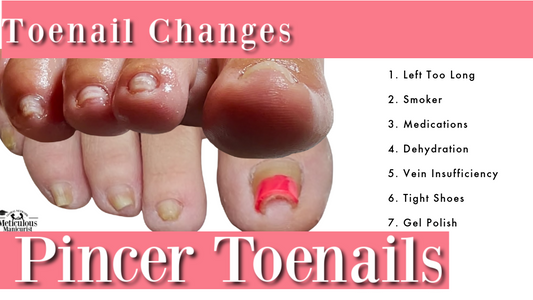 Best Tools for Thick, Curved, or Aging Toenails