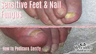 Toenail Care for Seniors: What You Need to Know